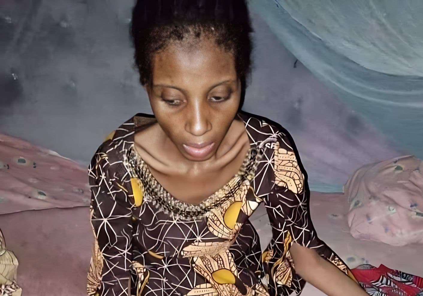 Cover Image for Nigerian man starves wife for a year; family demands justice after she dies in hospital